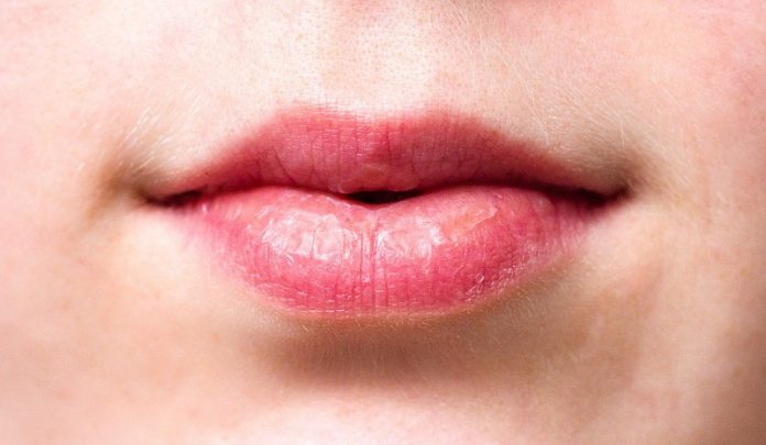 Dry and chapped lips can signal serious health conditions  