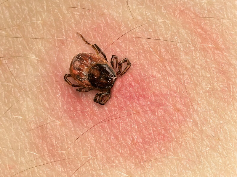 Symptoms and prevention of Lyme disease